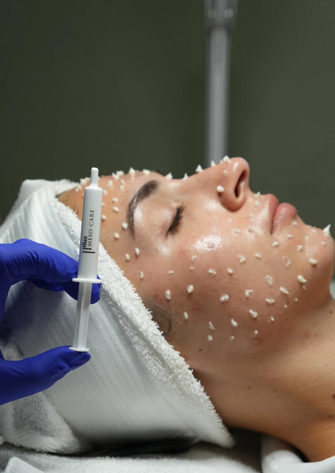 Korean Liquid Microneedling Facial: The Revolutionary Glass Skin Treatment Arrives in Seattle